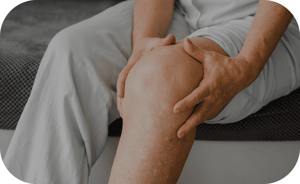 Arthritis (obesity-linked)